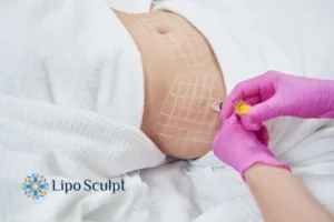 Are The Results From Aqualyx Permanent? 1 Do you want to know how long Aqualyx Purfleet results last?