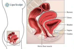 Treatment For A Leaky Bladder 2 How EM Chair treatment Purfleet can help Leaky bladder issues. Read more now!