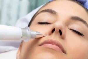Best Actinic Keratoses Removal 3 Actinic keratoses Purfleet solutions - book in today!